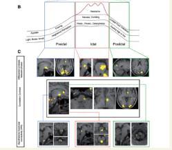 fmri studies activation and