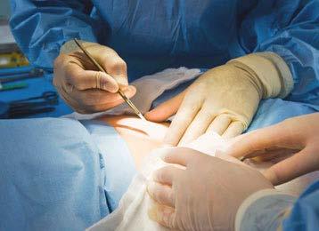 Complications rare, but can occur During surgery injury to organs anesthesia