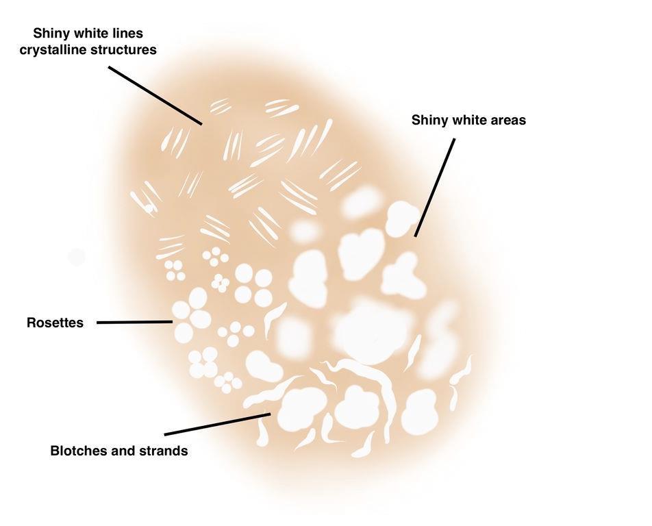white dot Though crystalline structures are the best known white structure associated with