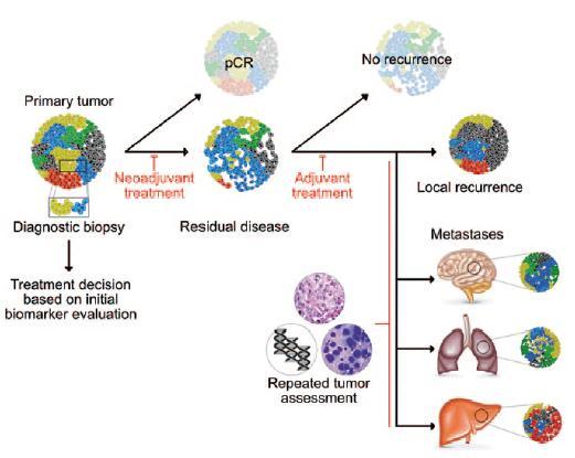 Time and Space-ITH can lead to underestimation of the tumor genomics landscape portrayed from a single tumor-biopsy samples and may represent major challenge to personalized-medicine and biomarker