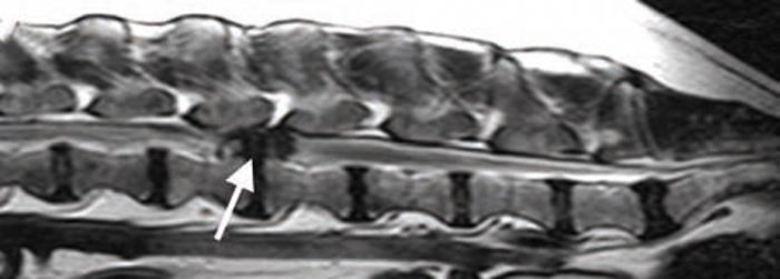Figure 4. Degenerative intervertebral disc disease (IVDD). A (sagittal T2-WI) and B (transverse T2-WI) are MRIs of a dog with IVDD type I.