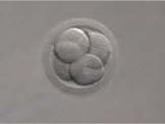 Fertility preservation - women Embryo cryopreservation * established methodology good results * ovarian stimulation takes time and this may delay the cancer treatment (random