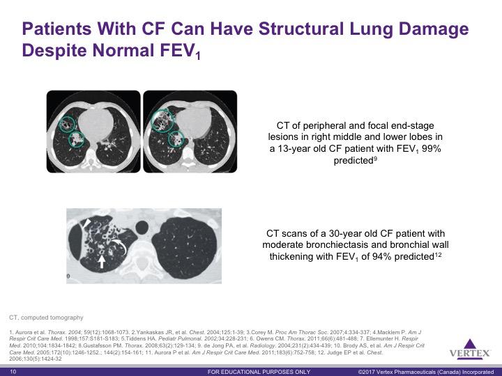 Key Points: 1. FEV 1 effectively measures disease progression in later stage lung disease, but is not sensitive enough to detect early localized or small airway obstructions 2-5 2.