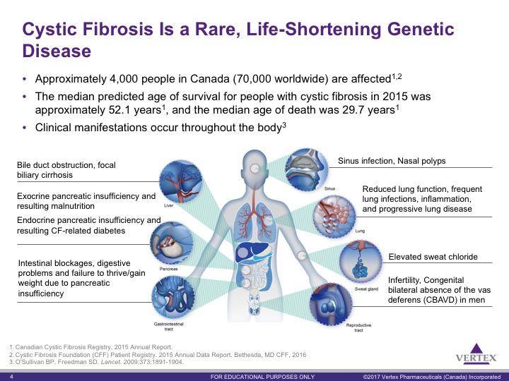 Cystic fibrosis is a rare life-long genetic disease that affects approximately 4,000 people in Canada and about 70,000 worldwide regardless of race or ethnicity but is more common in Caucasians 1,2
