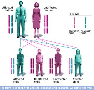 Genetic disorders Autosomal dominant genes First 22 pair of chromosomes One copy only Single gene defects often show racial variations