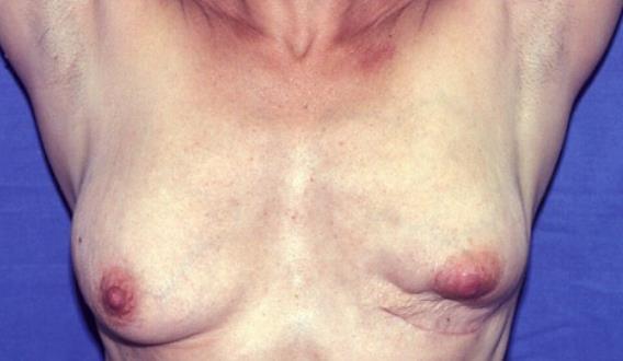Problems of breast