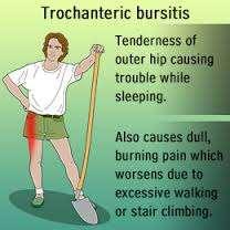 Greater trochanteric bursitis Pinpoint pain over the greater trochanter Tight