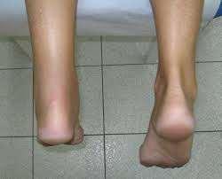 FOOT AND ANKLE DIFFERENTIAL DIAGNOSIS Medial/lateral
