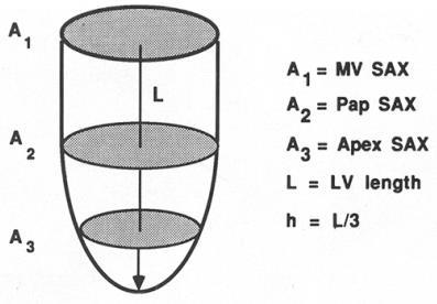 Parameters Definition (I) Volume(μl) = A mv + A Pap L + A apex L + π 3 2 3 6 **Amv: area of short axis at
