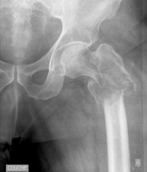 RADIOGRAPHS LONG BONES Available Simple