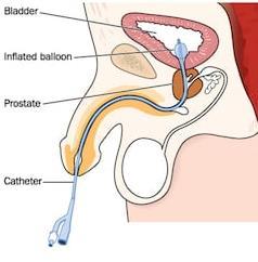 On each side of the urethra, the mucous membrane of the urethra presents a number of small mucous glands called the paraurethral glands which correspond to the prostate in the male.