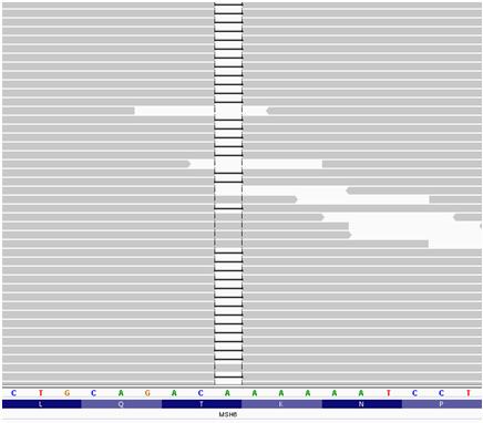 The first mutation (1) is a translocation between MSH2 intron 8 and chr18 q21.1 (top left), in which the breakpoints were confirmed by Sanger sequencing.