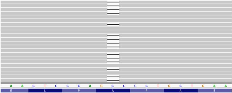p437lfsx54 (Lymph metastasis only) MLH1 exon 12 Supplementary Figure 9: Detail on Mismatch Repair Gene Mutations in 05-123.