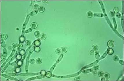 6- Yeast Yeast cells may be contaminants or represent a true yeast infection.