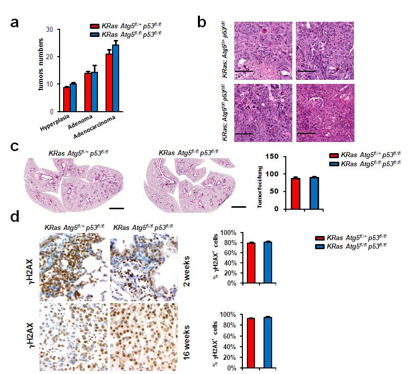 Supplementary Figure 10. Loss of p53 in autophagy deficient KRas-driven lung tumors.