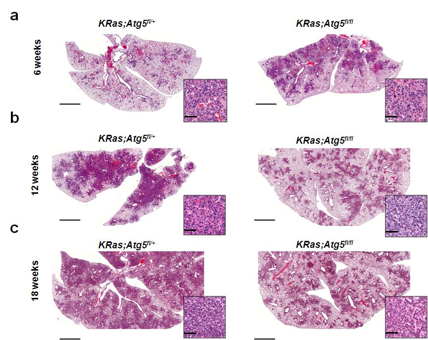 Supplementary Figure 2. Histology of Atg5-deficient KRas G12D -driven lung tumors.