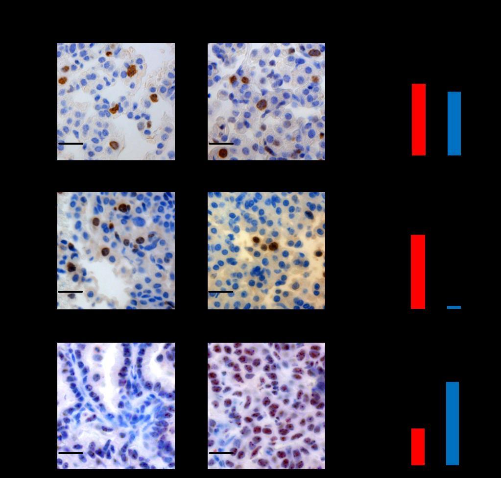 Supplementary Figure 4. Impaired proliferation and enhanced sensescence of Atg5 mutant lung tumor cells.