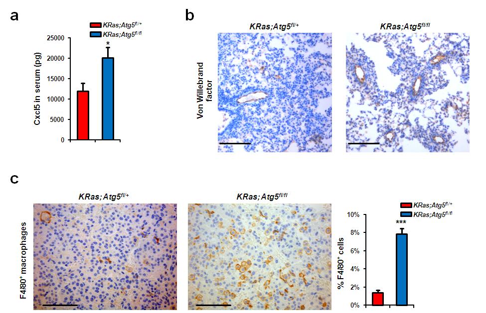 Supplementary Figure 7. Blood vessel formation and macrophage infiltration in lung tumors.