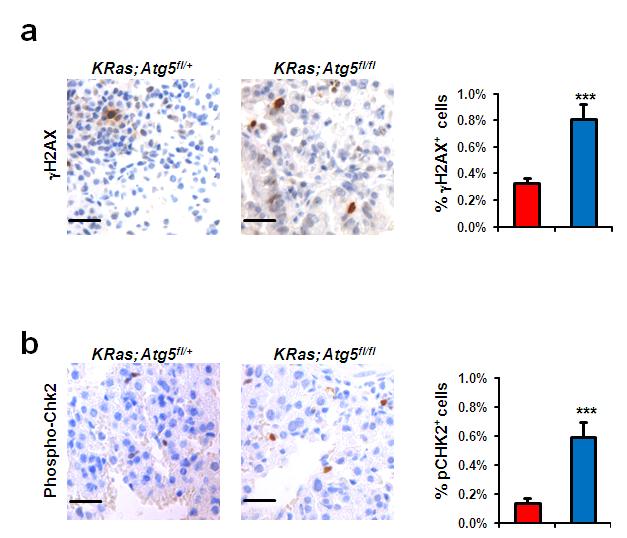 Supplementary Figure 9. Activation of the DNA damage response in autophagy deficient lung tumors.