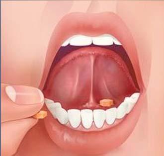 buccal tabs tab absorbed via the buccal (cheek) mucosa in the mouth do not swallow tab / place between cheek and gums and allow to