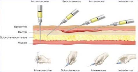 intramuscular injected into a muscle by positioning the needle and syringe at 90 o angle from the skin absorption is fairly rapid (vascularity of muscle) subcutaneous injection into the fatty layer