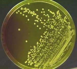 It is a selective media for staph species to differ between