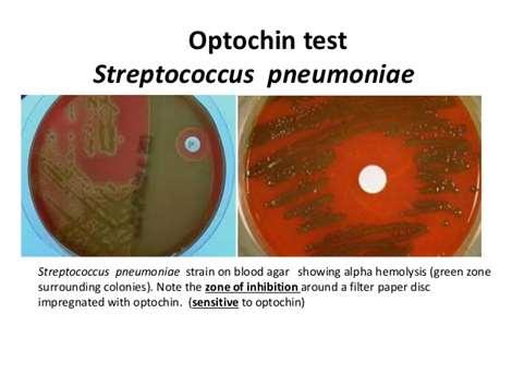 bacteria is sensitive >>>>strep.pneumonia 2.