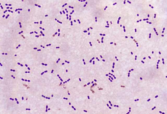 Streptococcus pneumoniae Lancet