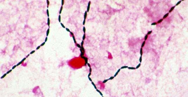 Streptococcus viridans When grown on agar,