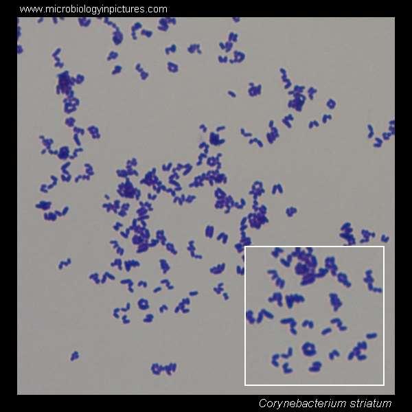 Diphtheroids Gram Positive Cocco-bacilli Present on normal flora of healthy
