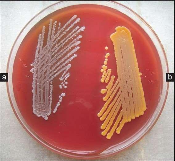 A- staphylococcus.albus B- staphylococcus.aureus Only staph.
