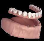 allow you to avoid using dentures by being placed directly on the mucous membranes,