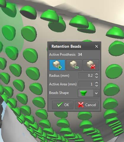 5. Retention beads new shape A new menu was added to the retention bead window from which you can choose between the default shape of beads or an improved profile.