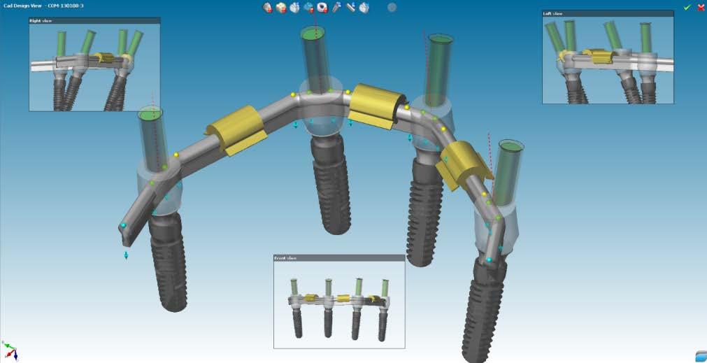 The new attachment kits are available for download at: http://download.dwos.com.