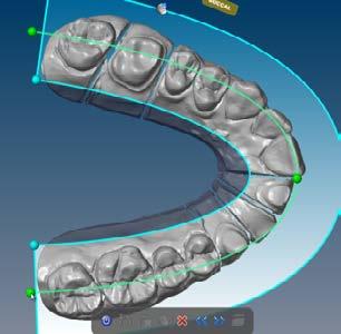 part of the model. Click and drag the Buccal handle until the orientation matches the model.