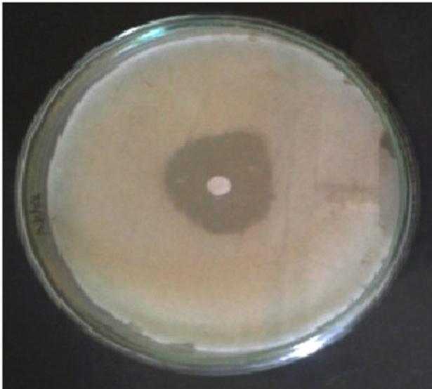 coli antibiotic disc. Fig5.