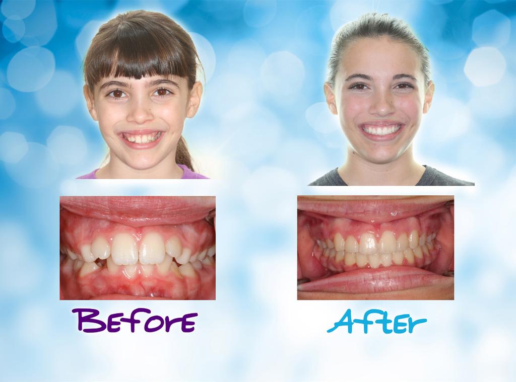 Our orthodontists at Burleson Orthodontics don t just treat orthodontic problems and pediatric patients; we also teach orthodontists at Children s Mercy Hospital how to become better orthodontists.