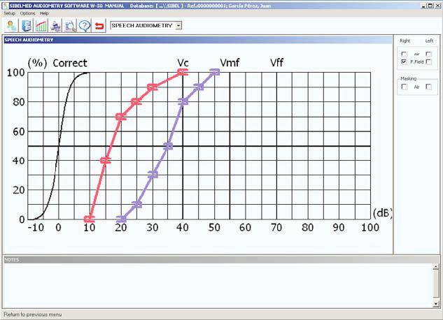 Software Manual SIBELMED W-50 48 Chapter 2: Audiometry Software W-50 SPEECH AUDIOMETRY Window showing graph of