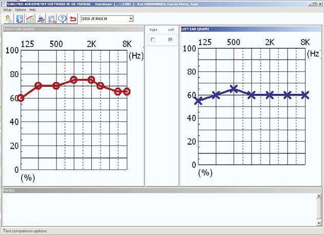 Software Manual SIBELMED W-50 49 SISI JERGER TEST Chapter 2: Audiometry Software W-50 Window showing graph of Correct Detections v