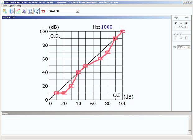 Software Manual SIBELMED W-50 50 Chapter 2: Audiometry Software W-50 FOWLER TEST Window showing graph