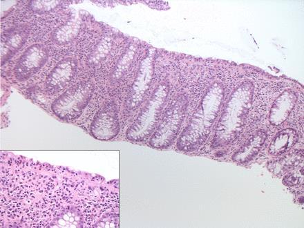 HISTOLOGICAL FEATURES OF