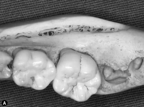 D4 is thin cortical bone with fine trabecular bone as seen in the interseptal bone of the maxillary and mandibular anterior teeth.