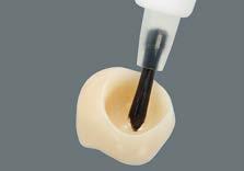 VITA ENAMIC Implant-supported crowns adhesive bonding on abutments Please note: To achieve optimum bonding of VITA ENAMIC crowns on implant abutments, the exclusive use of adhesive bonding is