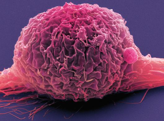 Measurable effects of immunotherapy for