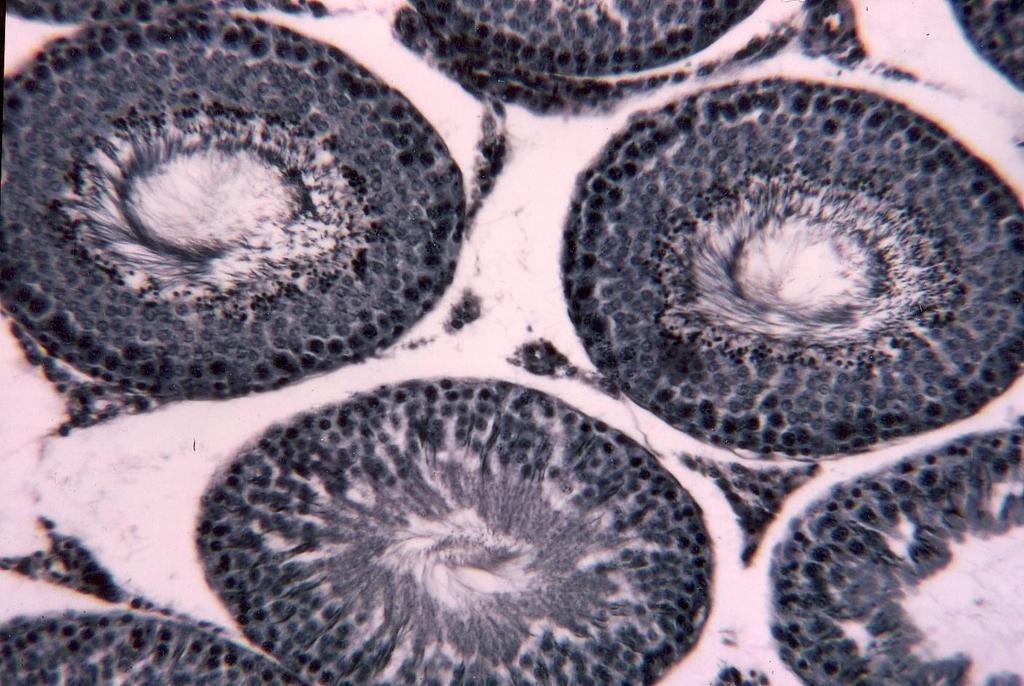 Interstitial/ Leydig Cells Seminiferous tubules Spermatogonia