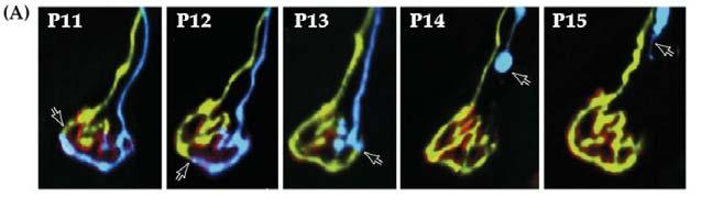 Live imaging of the same NMJ: At P11, two axons (blue & green) innervate the same muscle. AChR labeled in red.