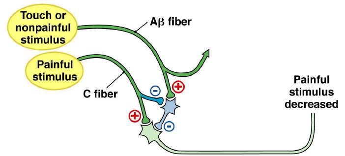 - Pain Subjective perceptin Fast pain Sharp and lcalised by Aδ fibers Slw pain Mre dull r diffuse by C fibers E.g.