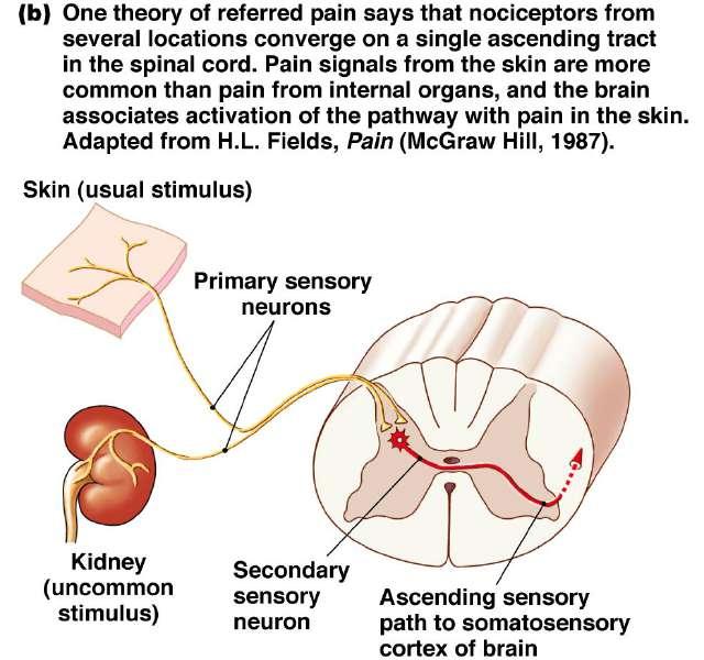 - Brain cannt distinguish visceral signals frm the mre cmmn signals arising frm