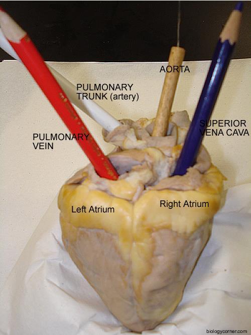 If the superior vena cava is not present, insert the scissors into the opening where the bl