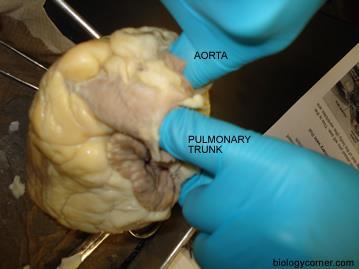 Continue to cut along the lateral margin of the right ventricle to the apex.